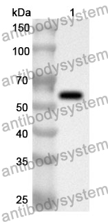 Anti-Porphyromonas gingivalis rgpB/Gingipain R2 Polyclonal Antibody